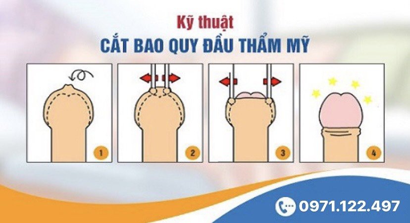 Quy trình cắt bao quy đầu an toàn